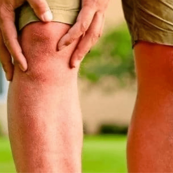 Buy Turmeric™ Gummies Canada Online