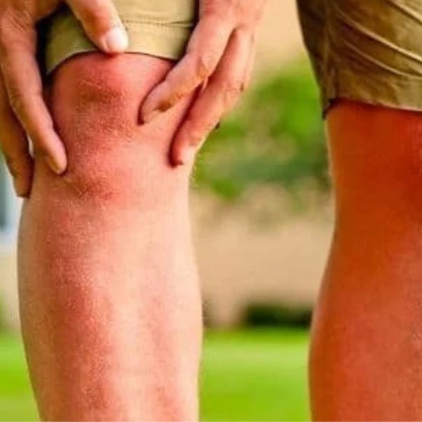 Buy Turmeric Mega™ Canada Online