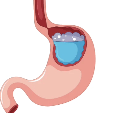 Frutin ™ Gastro Gel